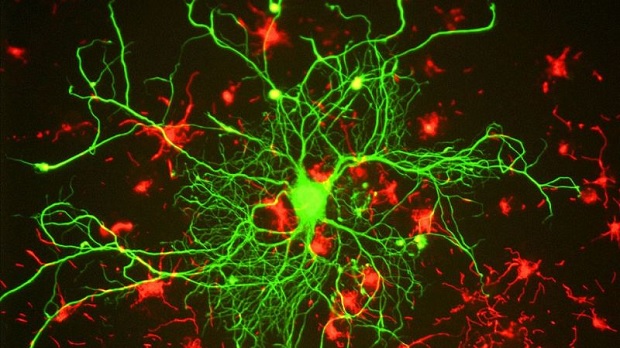 brain_scanning_b807352568de19fde9a3a6141